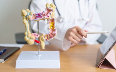 A diferença entre doença diverticular, diverticulose e diverticulite