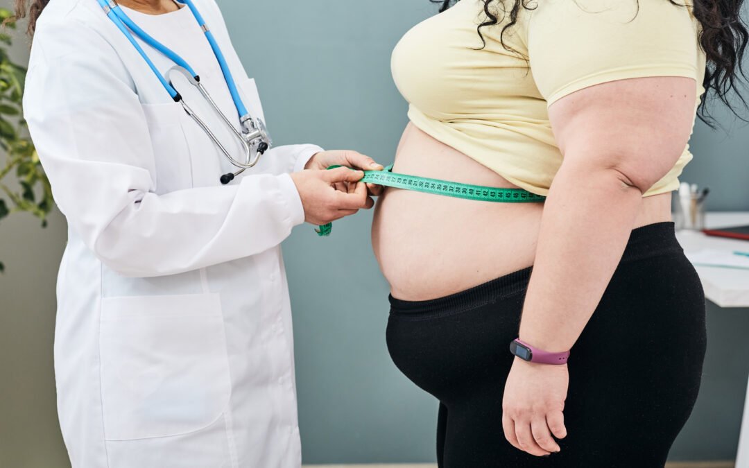 obesidade hereditária